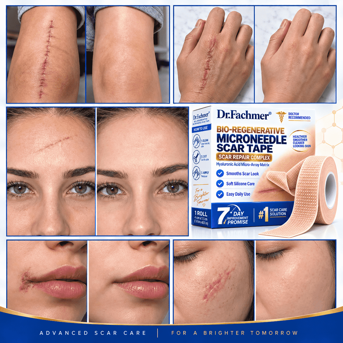😍Dr.Fachmer® Bio-Regenerative Microneedle Scar Tape