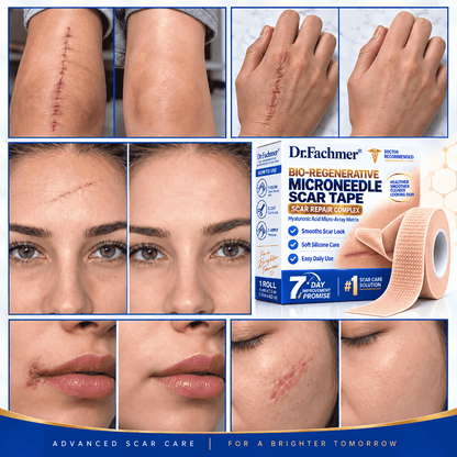 😍Dr.Fachmer® Bio-Regenerative Microneedle Scar Tape
